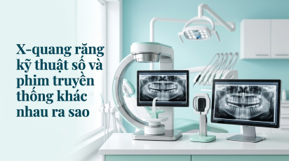 X-quang răng kỹ thuật số và phim truyền thống khác nhau ra sao