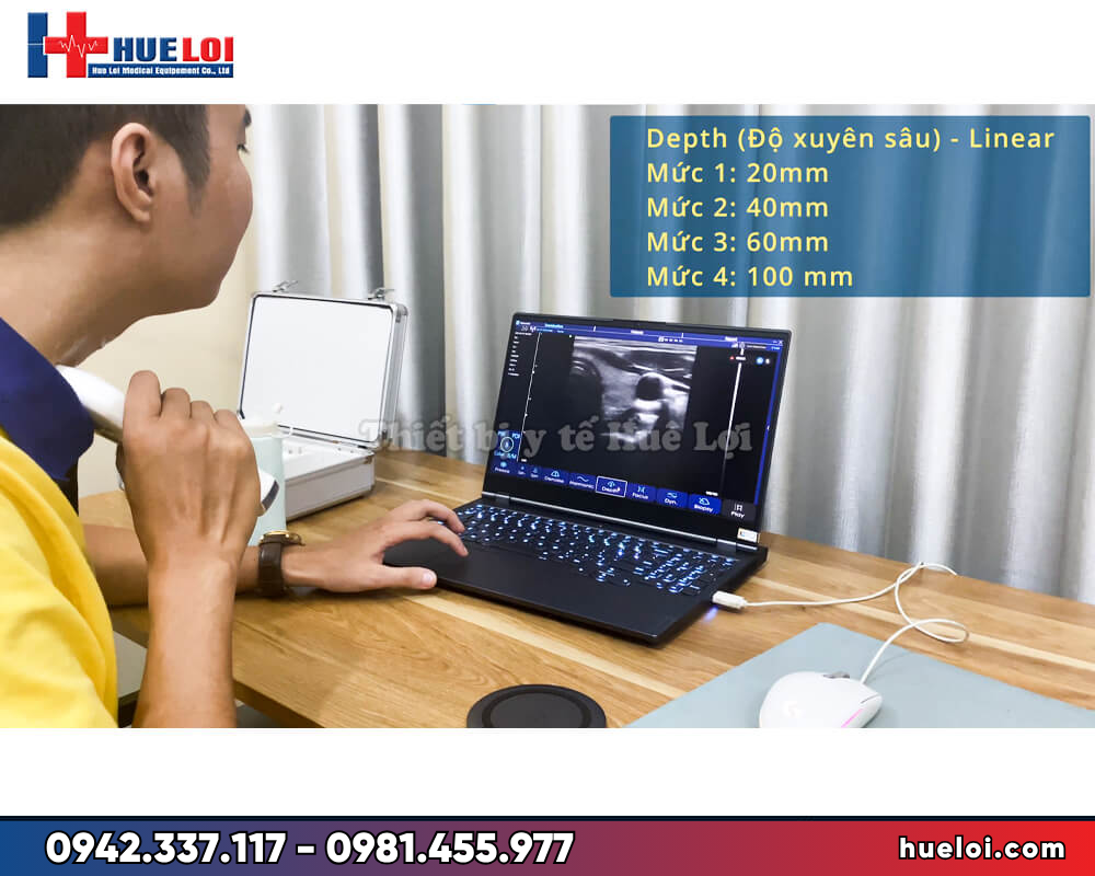 máy siêu âm cầm tay di động giá rẻ