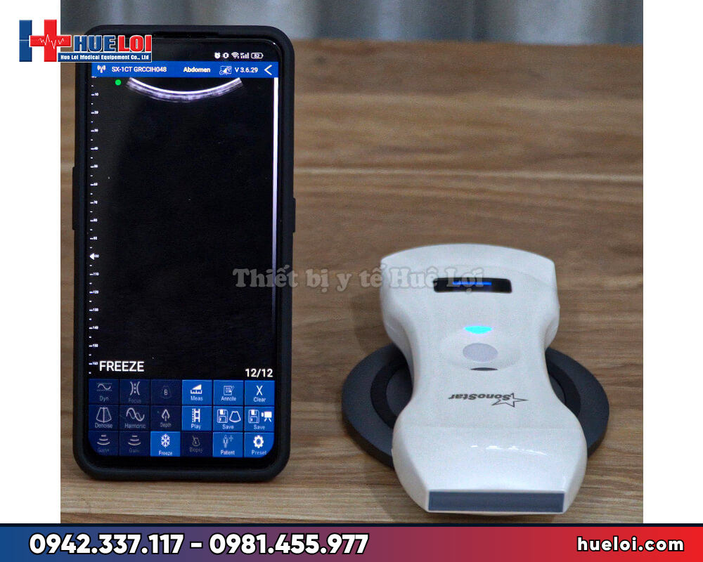 máy siêu âm cầm tay SonoStar kết nối điện thoại giá rẻ