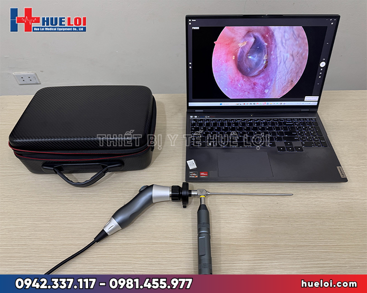 Máy nội soi tai mũi họng xách tay Full HD - giải pháp nội soi giá 14 triệu cho phòng khám mới