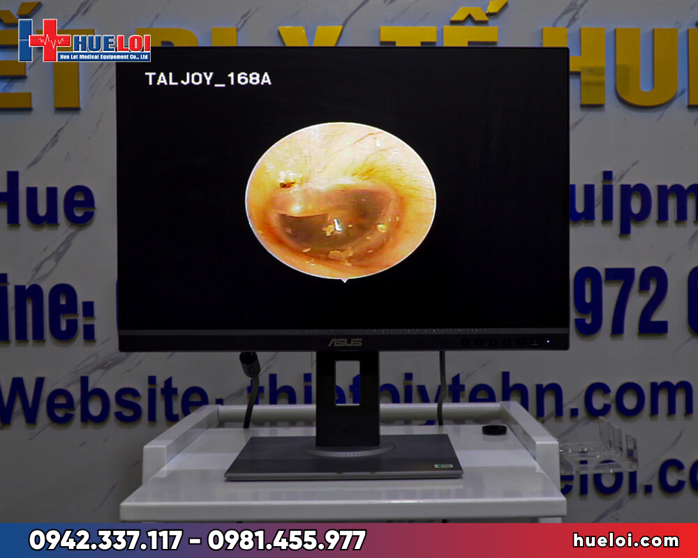 Máy nội soi tai mũi họng TJ-168A - màn hình 24 inch IPS Full HD hiển thị hình nội soi