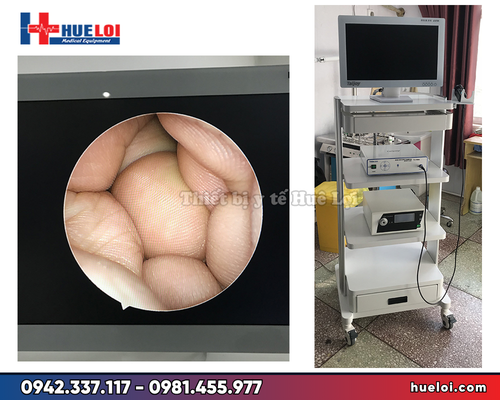 Máy nội soi tai mũi họng TJ-168A - toàn cảnh hệ thống trên kệ đựng máy