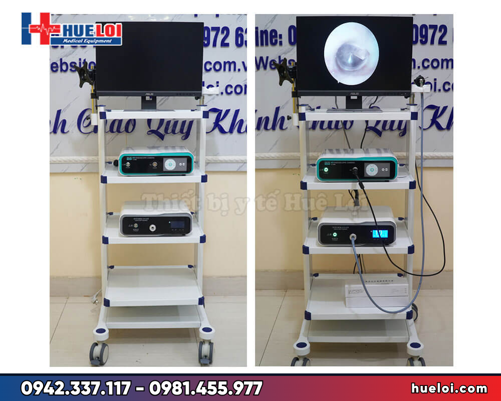 Máy nội soi tai mũi họng TJ-168B - hệ thống hoàn chỉnh tại phòng khám