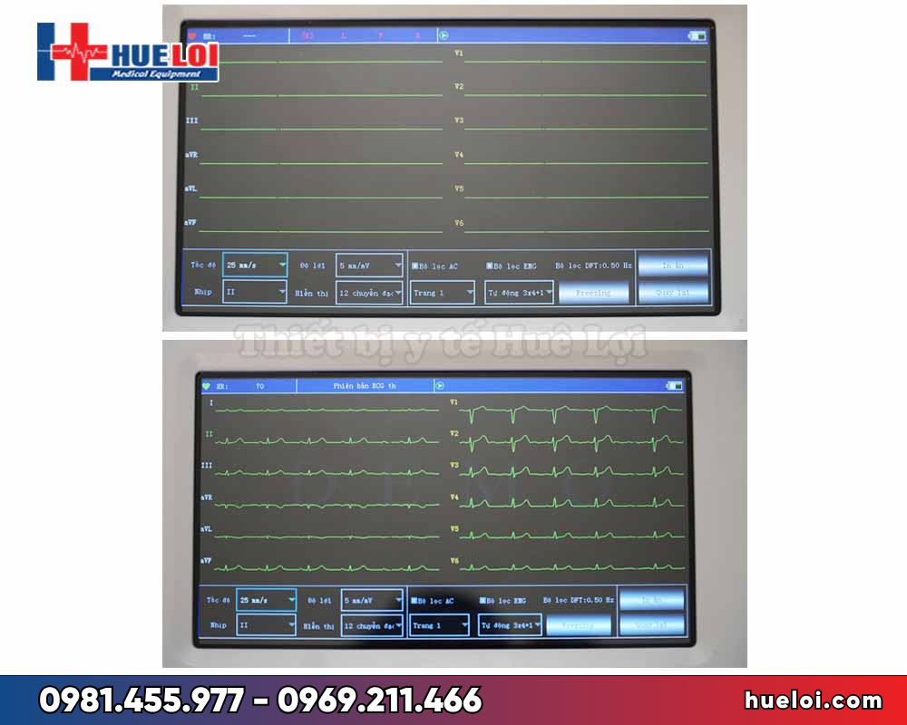 Máy điện tim 6 kênh Contec-600G- 12 đạo trình