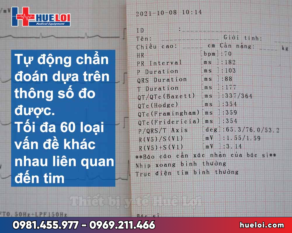 Máy điện tim 6 kênh Contec-600G- phiếu kết quả 
