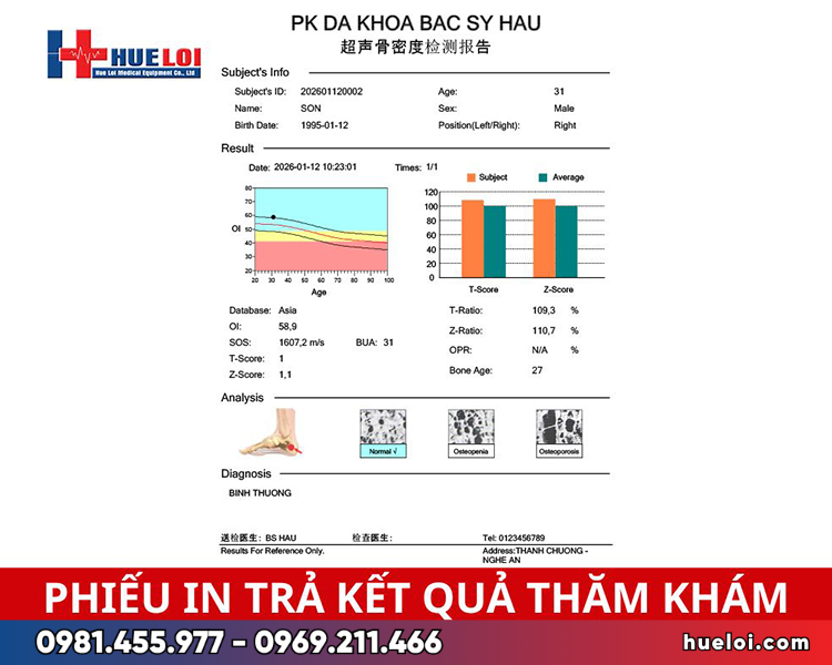 Máy đo loãng xương gót chân siêu âm OSTEOKJ3000- phiếu trả kết quả