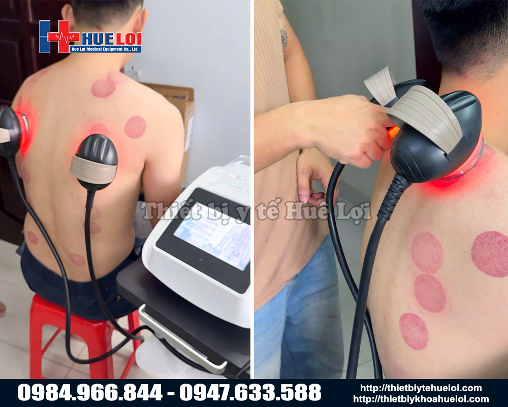 Thực tế sử dụng máy điện sinh học hiện đại