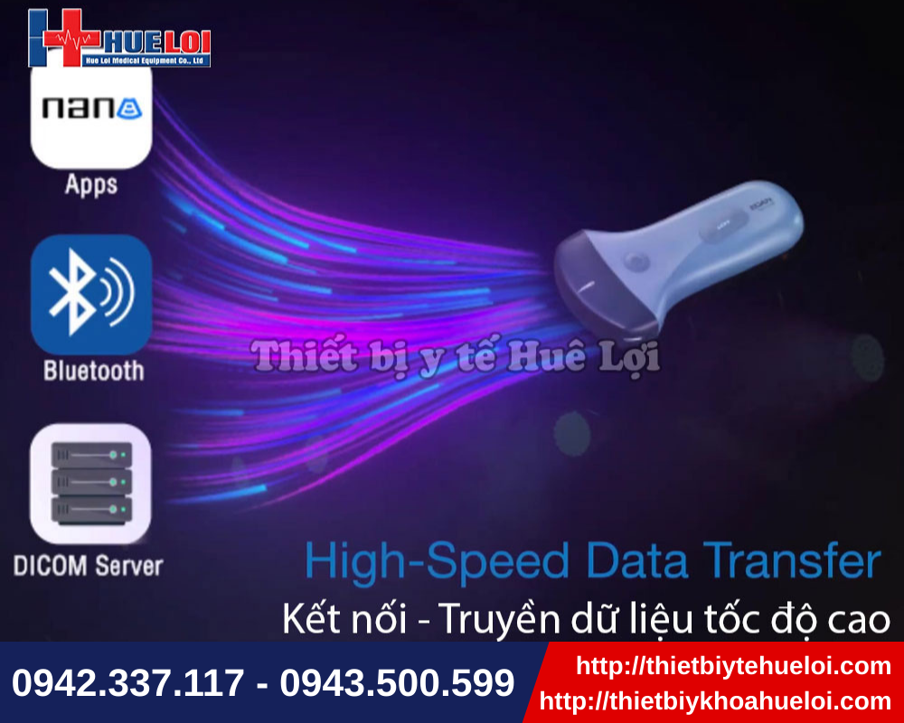 Đa dạng phương thức kết nối với máy siêu âm cầm tay