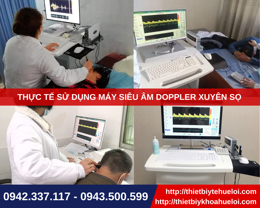 Thực tế sử dụng máy siêu âm doppler xuyên sọ