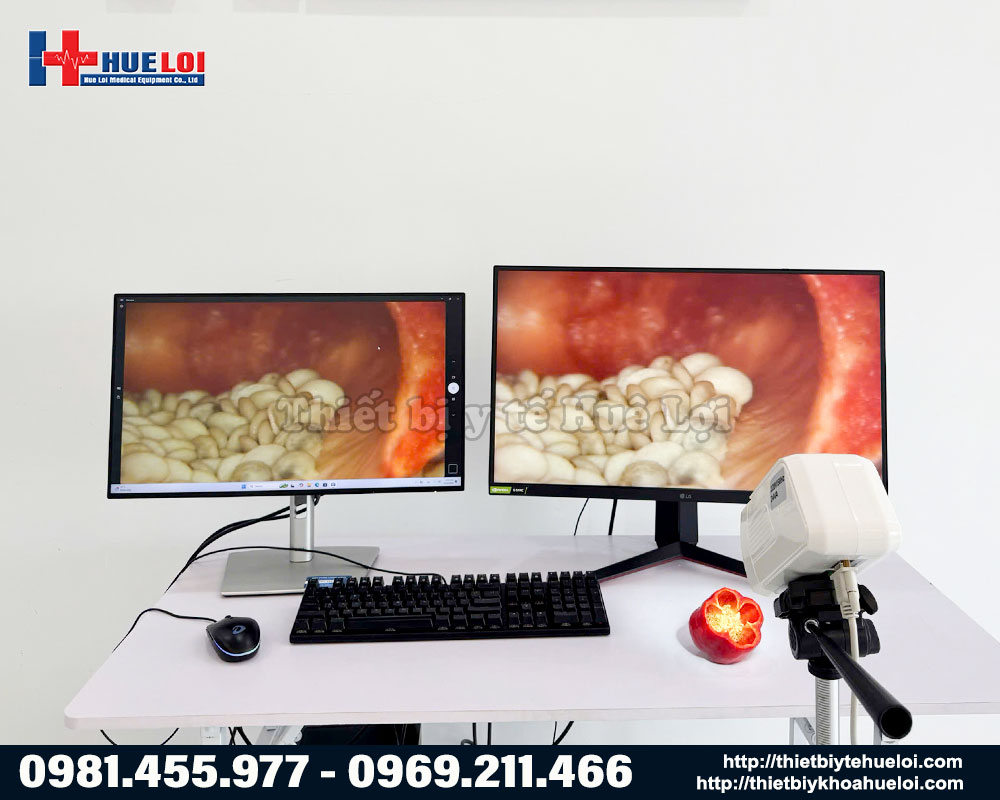 máy soi cổ tử cung SW-302 - chất lượng hình ảnh