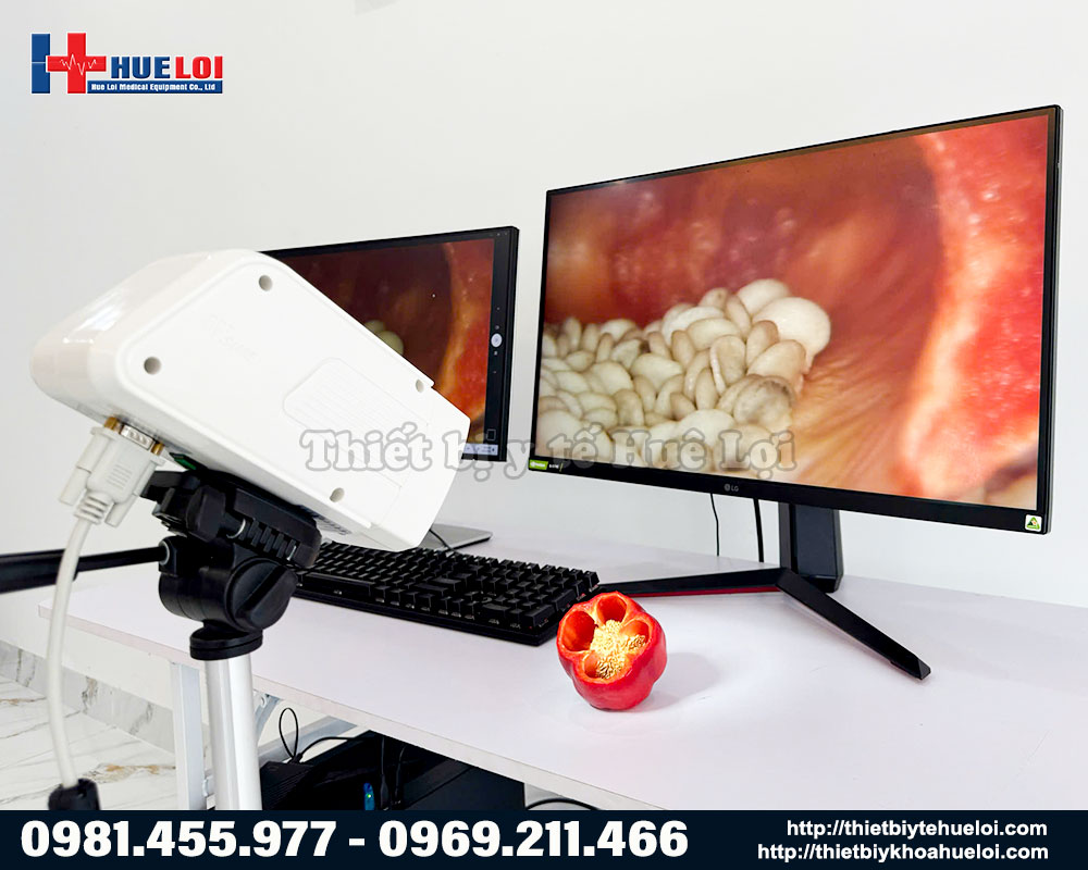 máy soi cổ tử cung SW-302 - chất lượng hình ảnh hiển thị trên màn hình