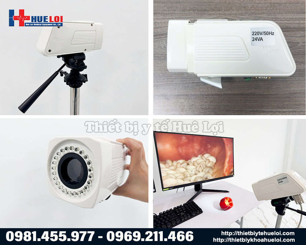 máy soi cổ tử cung SW-302 - ảnh các góc chi tiết