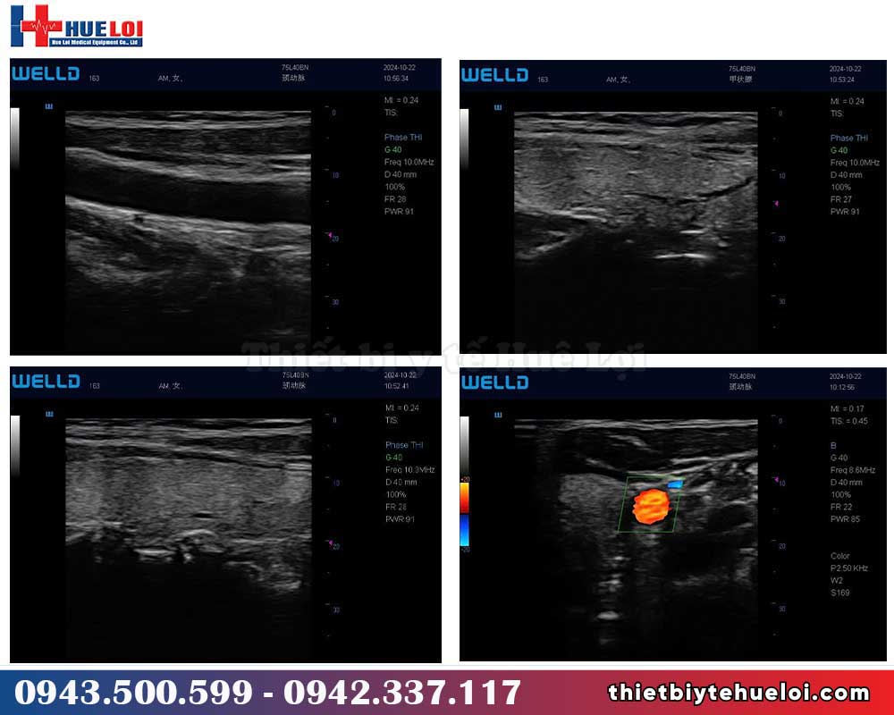 chất lượng hình ảnh siêu âm xách tay giá rẻ