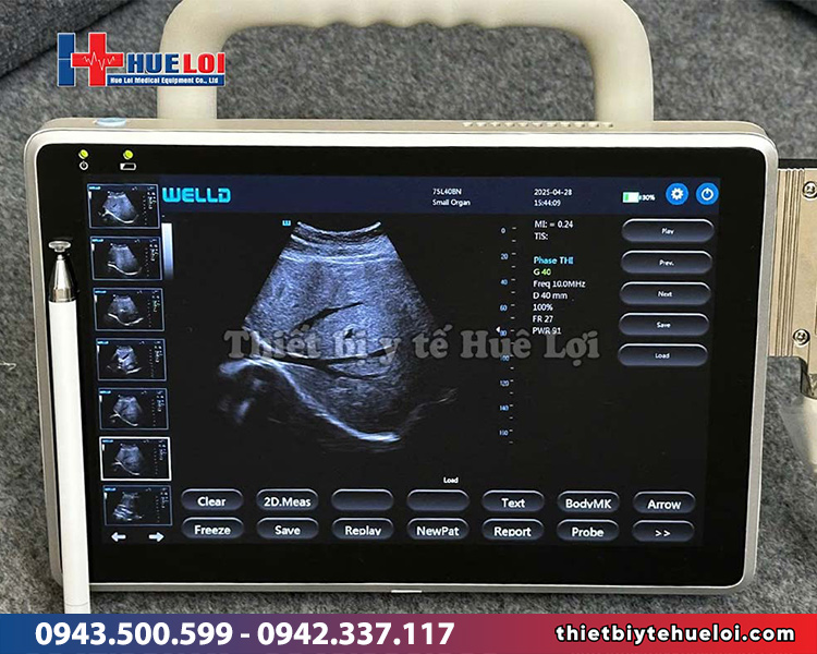 máy siêu âm cảm ứng giá rẻ