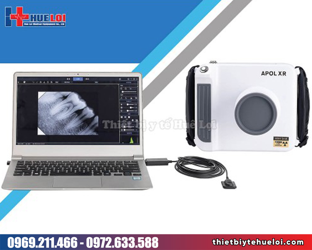Máy chụp x-quang nha khoa cầm tay