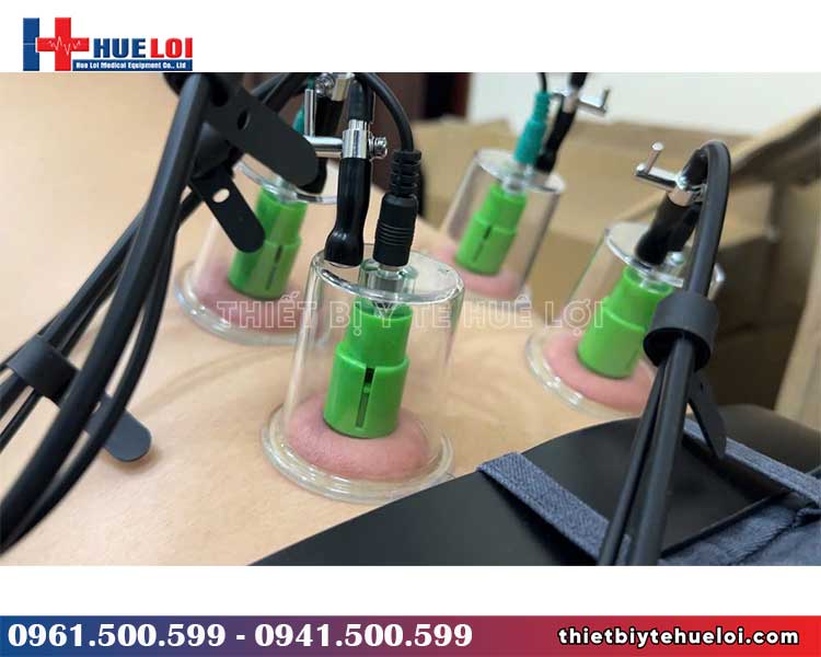 cốc điện châm cốc hút máy điện châm không kim giá rẻ