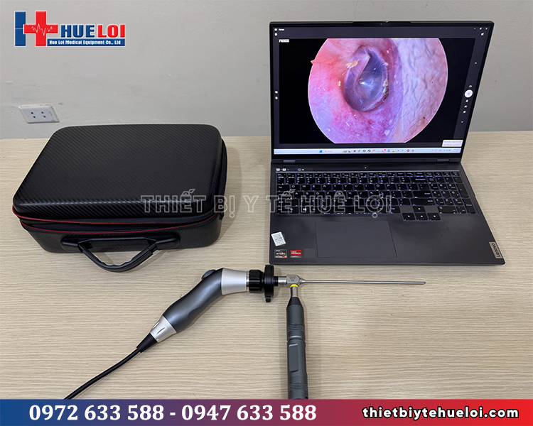 máy nội soi tai mũi họng mini