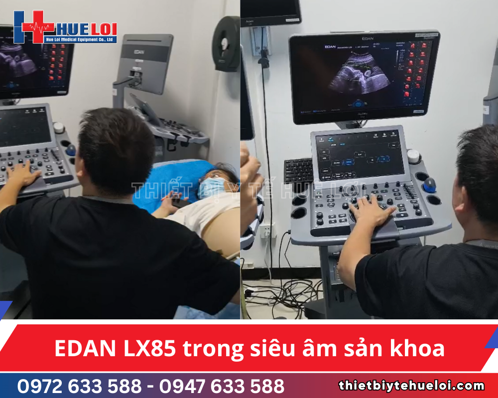 Máy siêu âm Doppler màu 5D