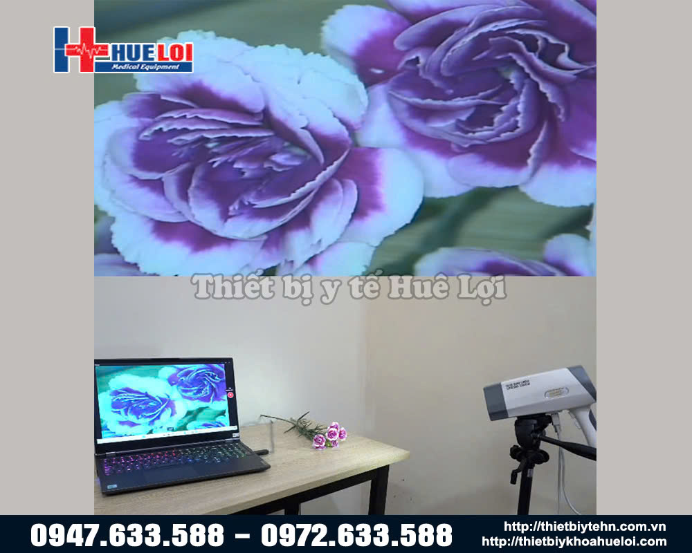 máy soi bệnh lý cổ tử cung