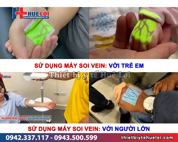 máy soi vein hồng ngoại
