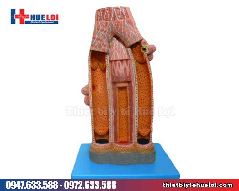 Mô hình động mạch tĩnh mạch phóng đại