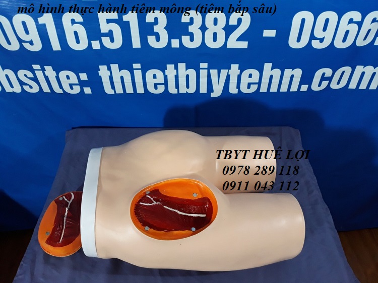 mo-hinh-tiem-bap-sau-thao-lap