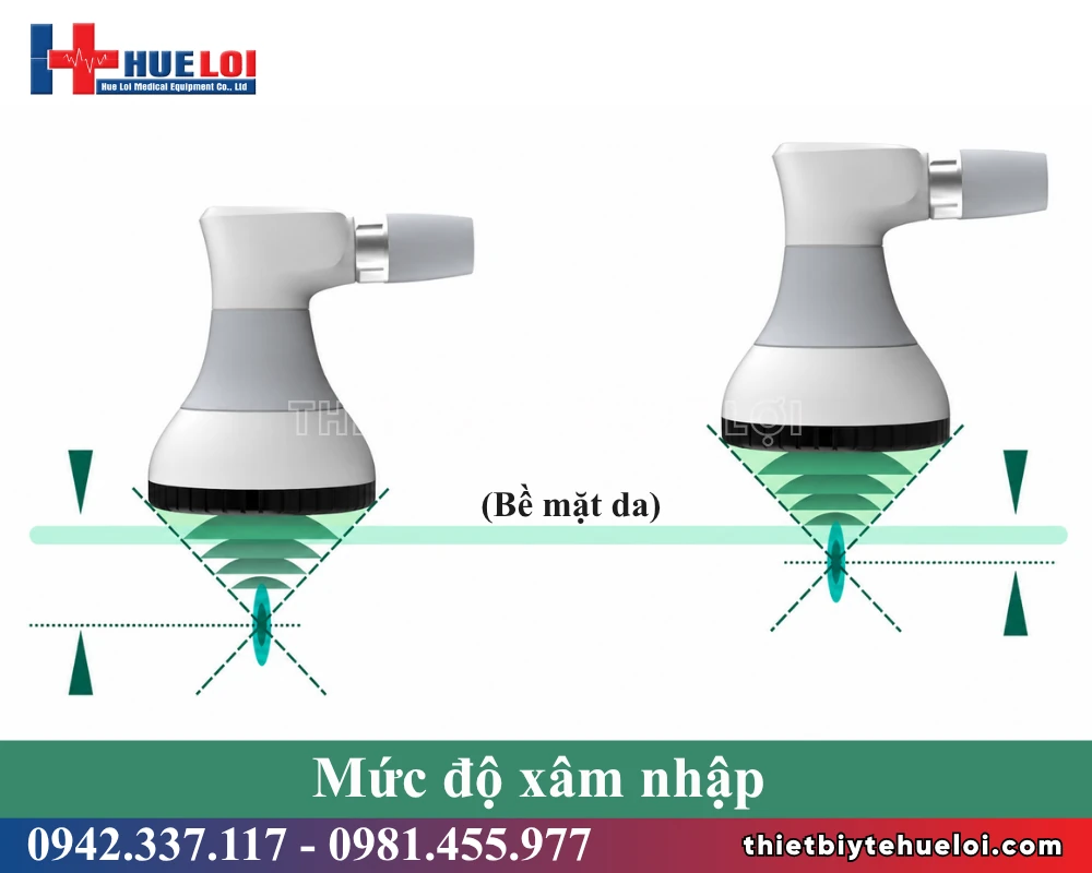 Máy sóng xung kích hội tụ áp điện Piezonia PZO-G1 – 7 đệm chọn độ sâu tới 65 mm