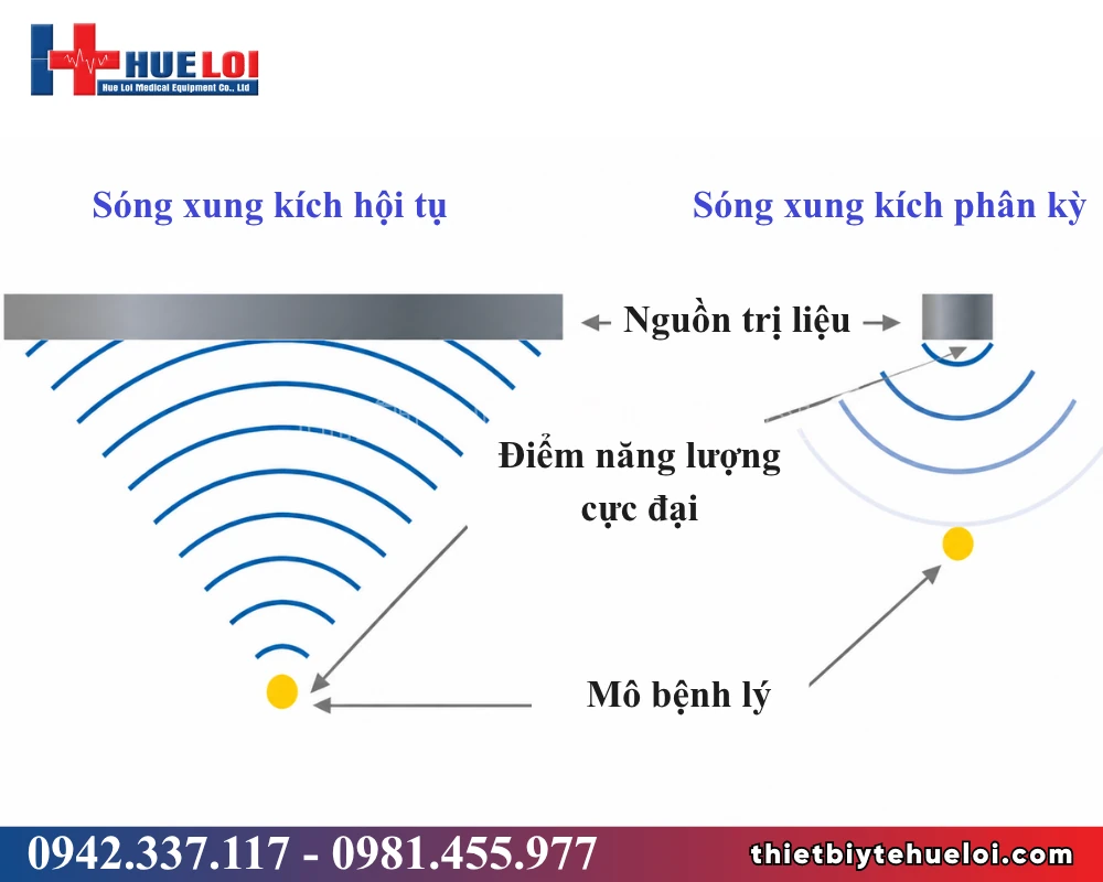 Máy sóng xung kích hội tụ áp điện Piezonia PZO-G1 – 7 đệm chọn độ sâu tới 65 mm