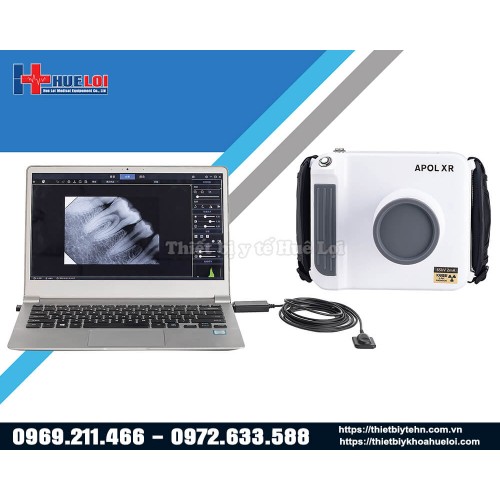 máy x-quang di động