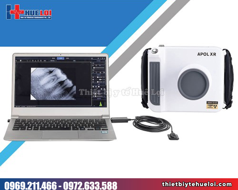 Sensor X-quang nha khoa