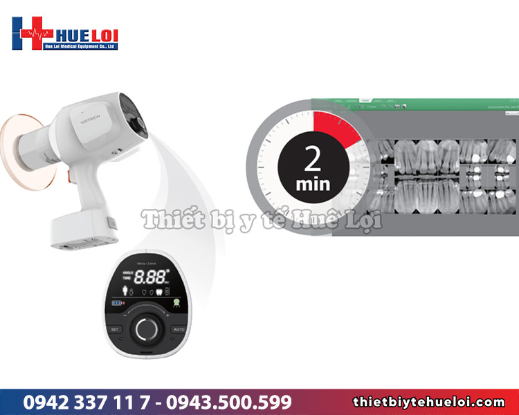 máy x-quang răng di động