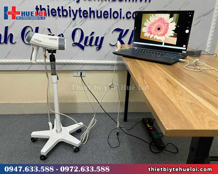 Máy nội soi cổ tử cung - YIKEDA SD 3002