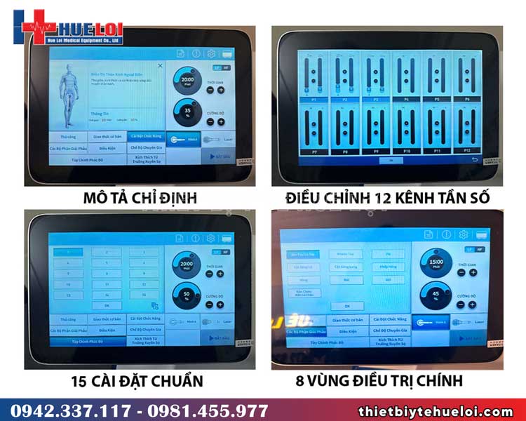 ưu điểm nổi bật của pmst-pro