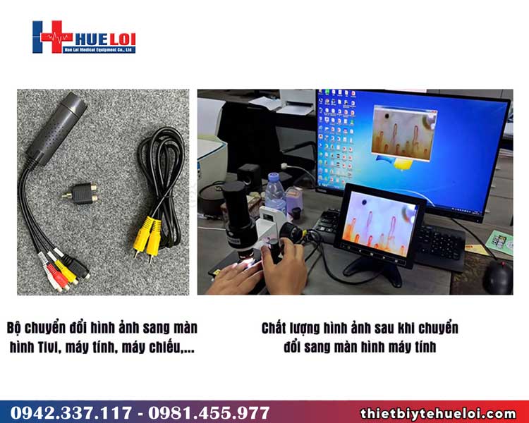 linh kiện chuyển đổi qua thiết bị khác của kính soi mạch máu dn-880