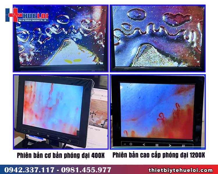 so sánh chất lượng hình ảnh của 2 loại kính hiển vi soi mạch